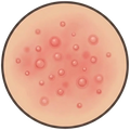 Target condition 5