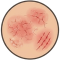 Target condition 3