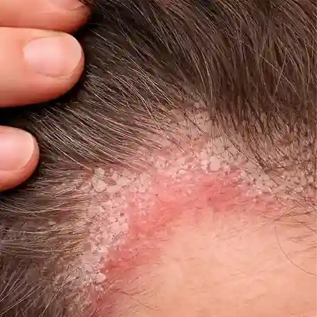 Scalp protocol access