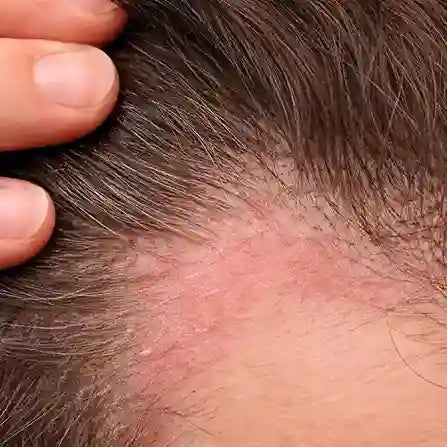 Scalp protocol access