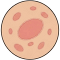 Target condition 4