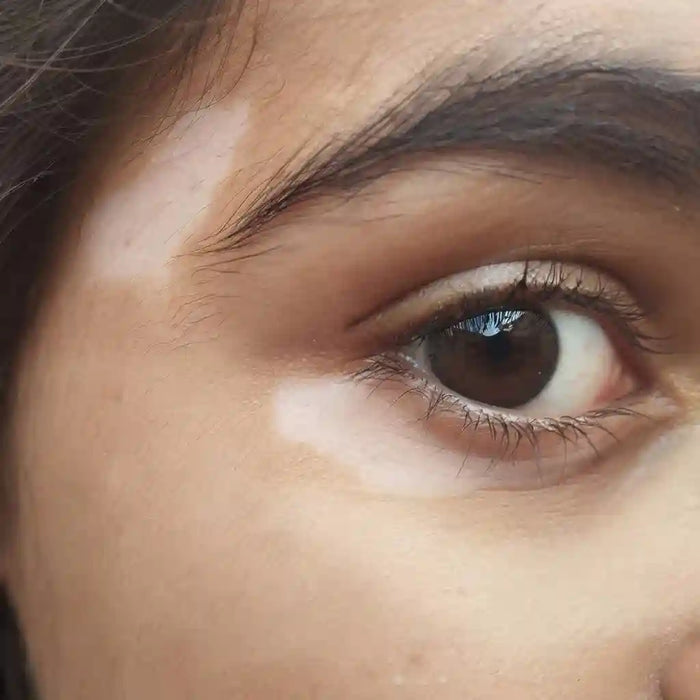 Clinic-grade plaque routine